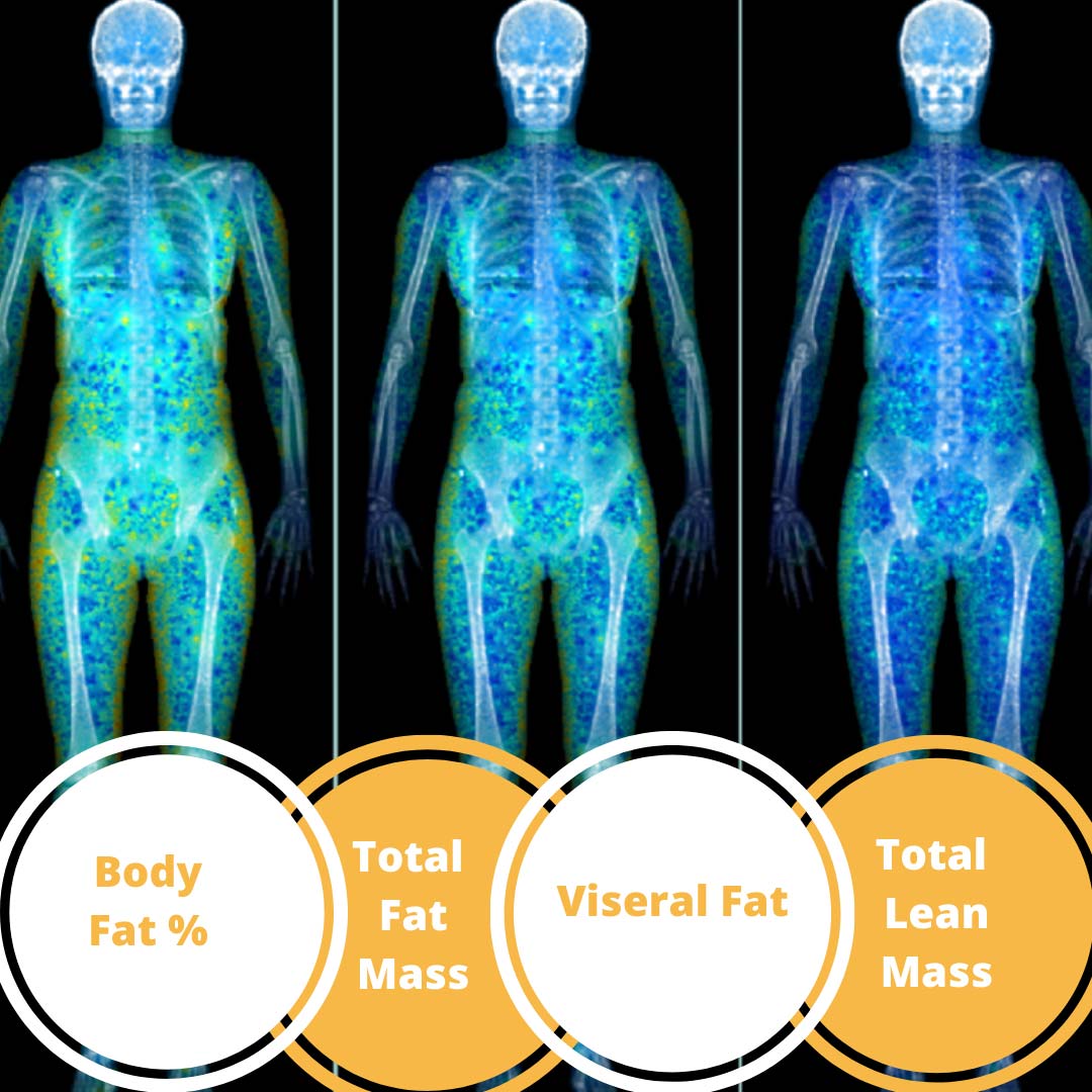 Body composition scan, Body scan near me